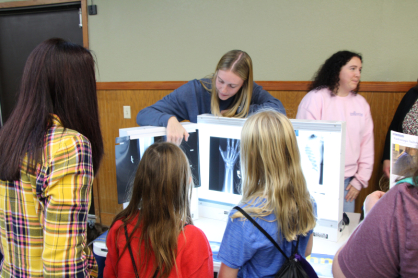 Showing xrays.